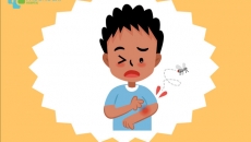 PCGH: Chăm sóc trẻ sốt xuất huyết Dengue